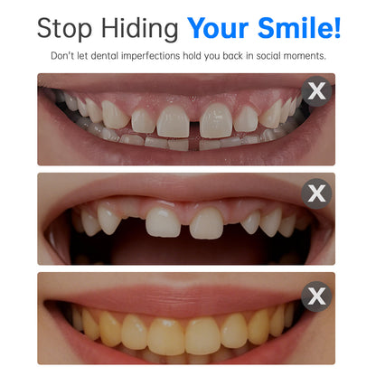 YAGOO® 3-Step Emergency Teeth Repair Kit (Natural White)
