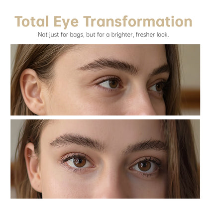 60% OFF 🔥 Instant Eye Lift Gel for Bags & Dark Circles