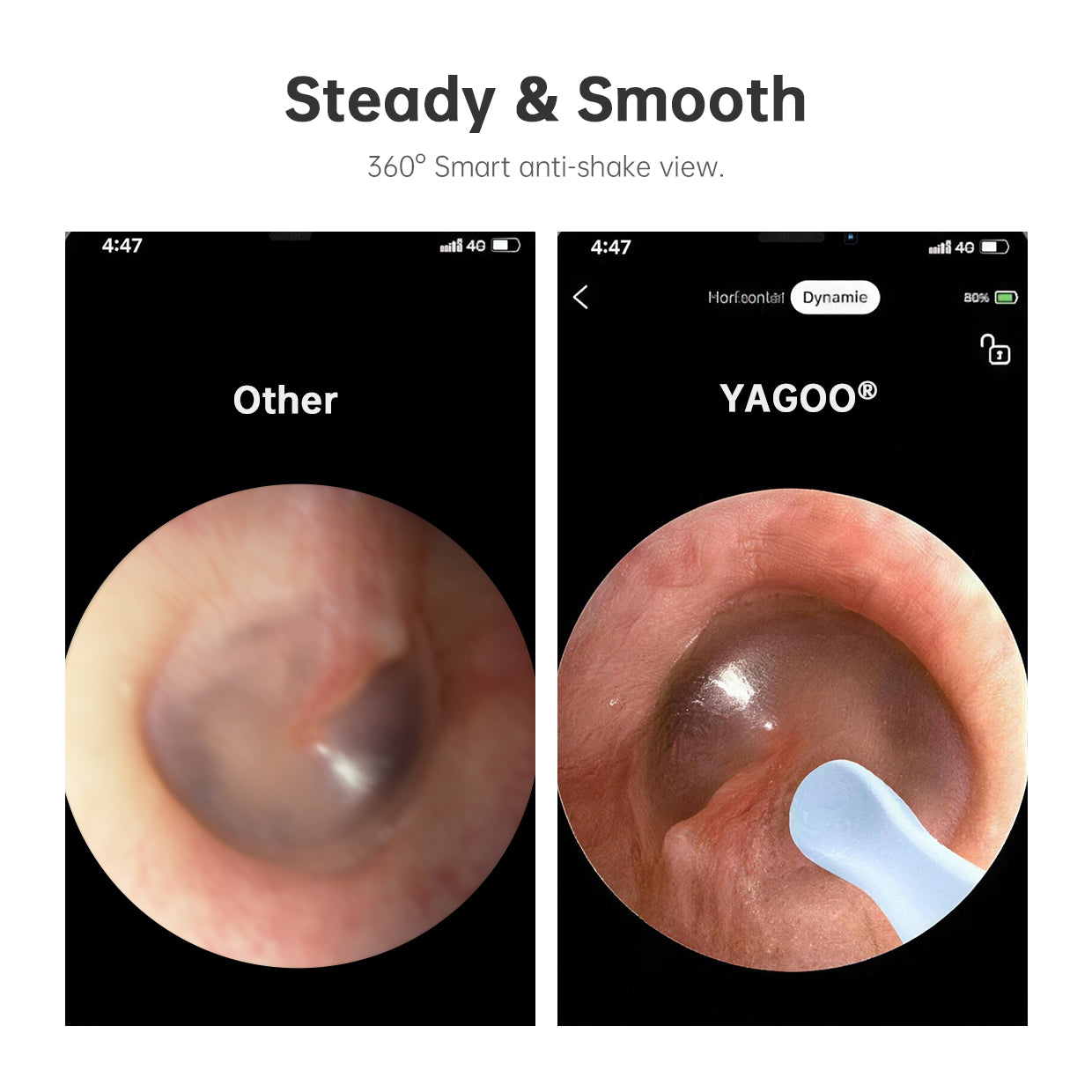 YAGOO® Pro Visual Ear Cleaner - HD Camera Ear Pick Kit