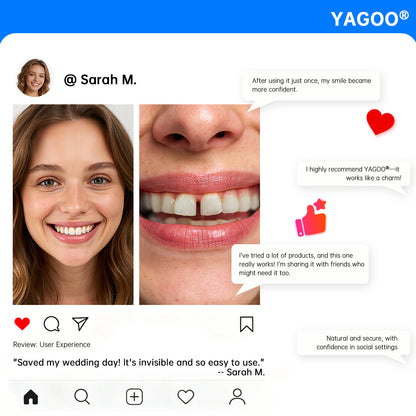 YAGOO® 3-Step Emergency Teeth Repair Kit (Natural White)